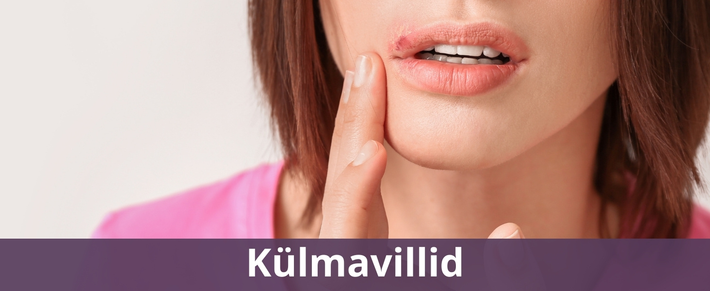 Külmavillid